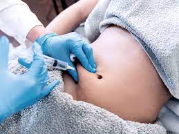Fat Burner Injections: Your Guide to a Healthier, Slimmer You!