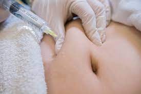 Lipo Lab Treatment Areas: Get Rid of Stubborn Fat with Targeted Solutions