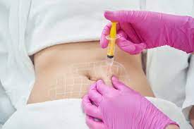 The Skinny on Lipolysis Injections: Are They Worth It?