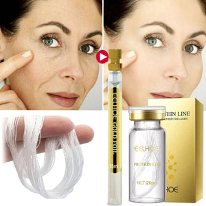 Collagen Thread Lift Set Anti-Aging