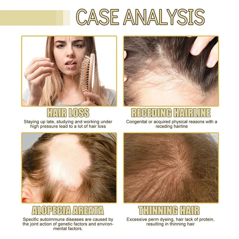 EELHOE hair growth oil