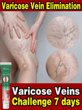 Effective Varicose Vein Treatment Cream