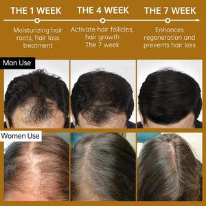 Fast Hair Growth Serum Anti-Loss Treatment