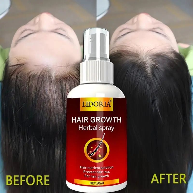 Ginger Hair Growth Serum Natural Care. 	
best hair growth serum South Africa