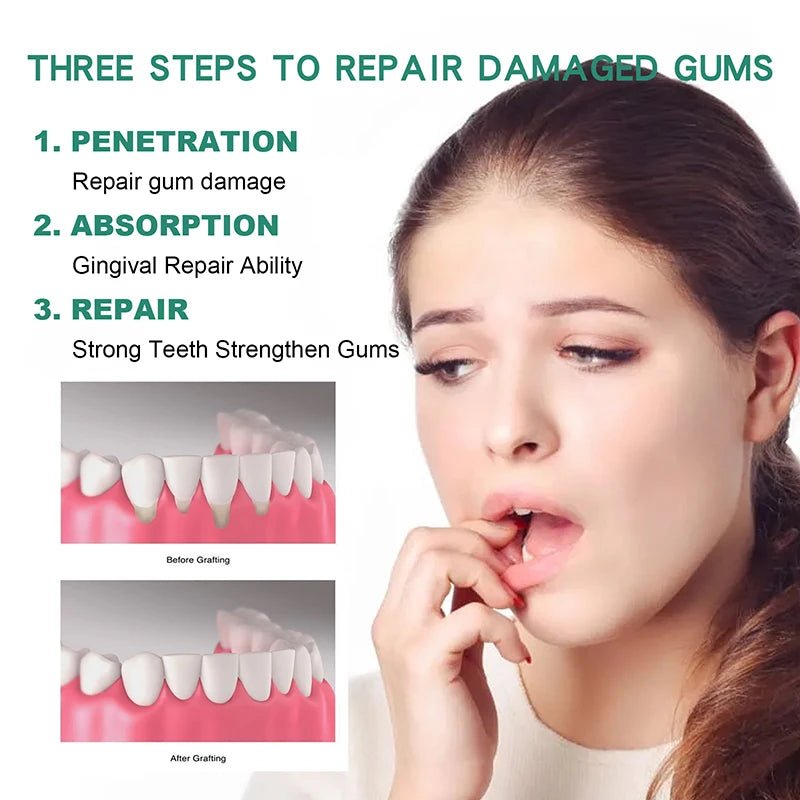 Gum Regrowth Drops 30ml - periodontal disease pain relief