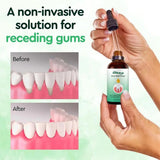 Gum Regrowth Treatment Drops 30ml. Buy in South africa