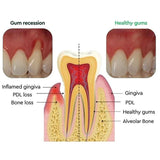 Gum Regrowth Treatment Drops 30ml