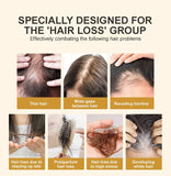 Hair Growth Spray - Anti-Hair Loss Spray South Africa