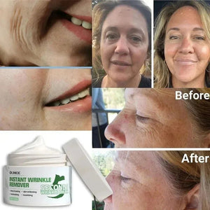 Instant Wrinkle Remover Retinol Face Cream