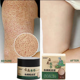 Keratosis Pilaris Repair Cream Moisturizer