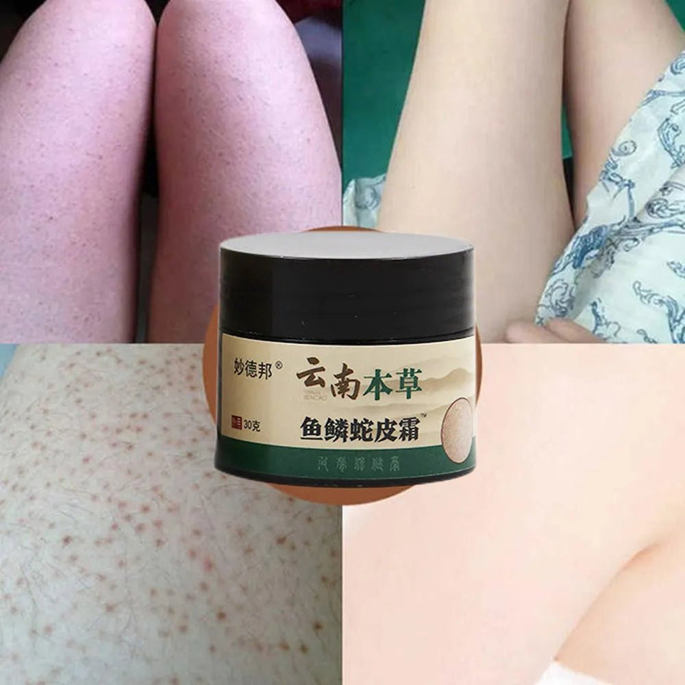 Keratosis Pilaris Repair Cream Moisturizer