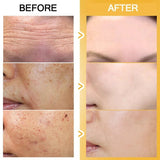 Niacinamide Serum Face Moisturizing Skin Care