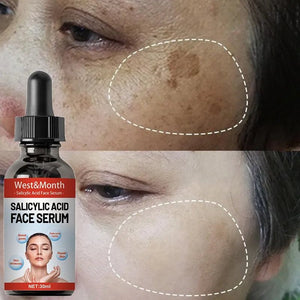 Nicotinamide Salicylic Acid Facial Essence