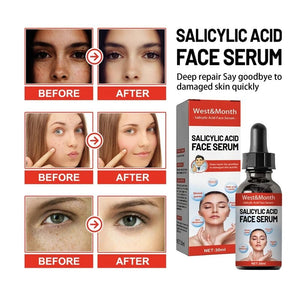 Nicotinamide Salicylic Acid Facial Essence