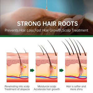 Rosemary Ginger Hair Growth Oil Treatment