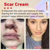 Scar Removal Cream - Acne Scar removal cream