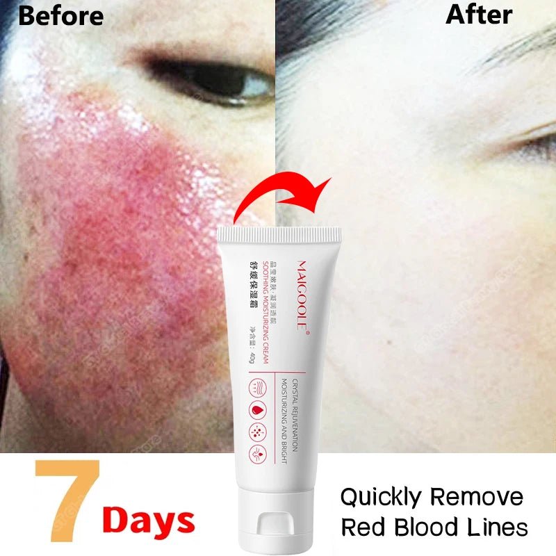 Sensitive Skin Redness Relief Repair Cream