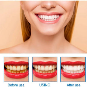 Buy Teeth Whitening Serum in South Africa