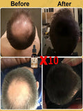 Best Hair Growth Oil Treatment