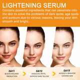 Vitamin C Whitening Serum with Hyaluronic South Africa